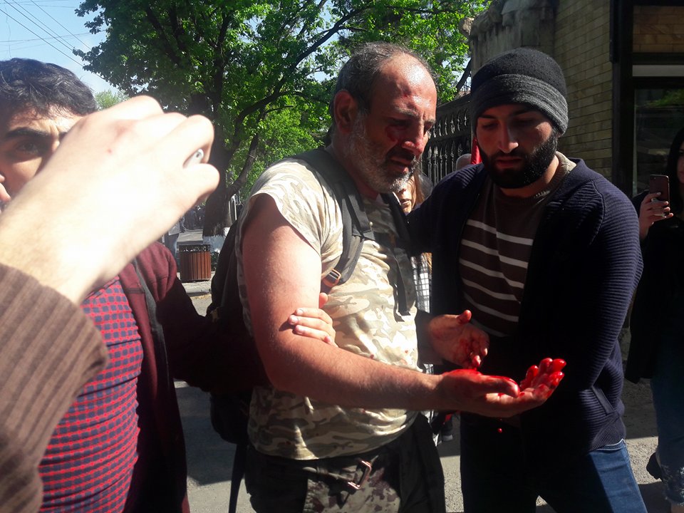 Yerevan’daki protestoların lideri hastaneye kaldırıldı