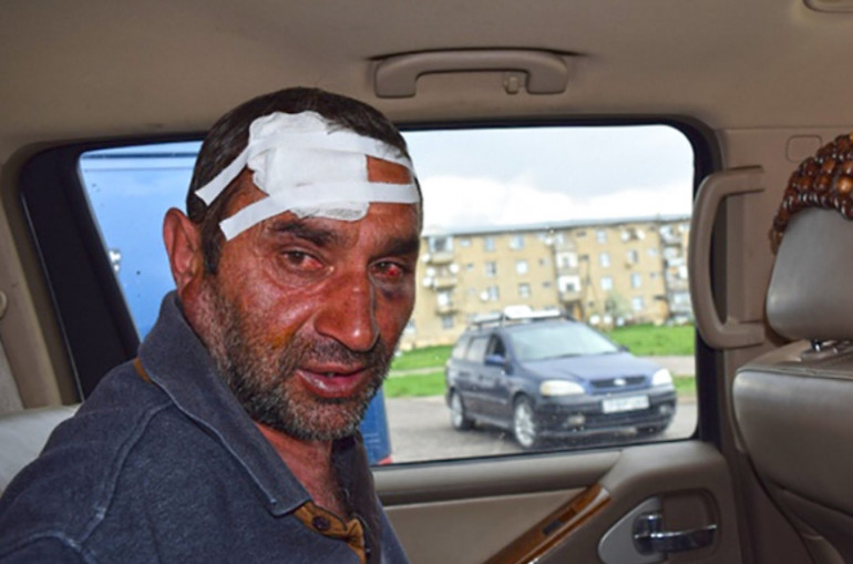 Турецкие грабители жестоко избили пожилого армянина в Грузии