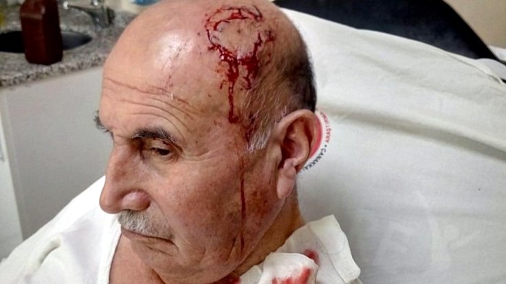Разговор на курдском, стал причиной избиения пожилого человека в Турции