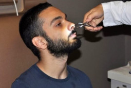 Թուրք երիտասարդը 6 տարի շարունակ ապրել է քթի մեջ ատամով (լուսանկարներ)