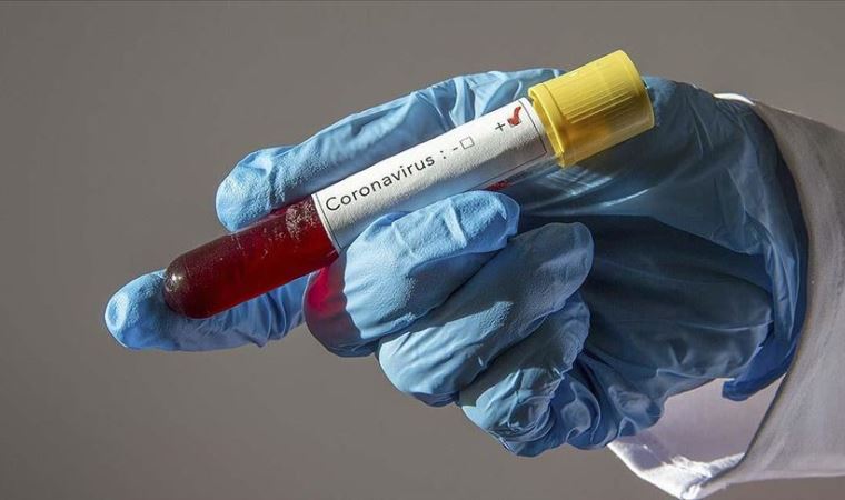 Koronavirüs salgınında ölü sayısı 14 bin 706'ya yükseldi