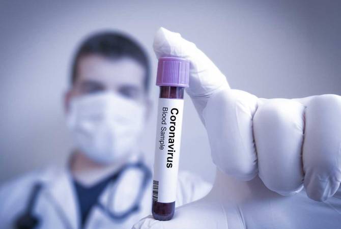 Ermenistan'da koronavirüsü yenen hasta sayısı 18'e ulaştı