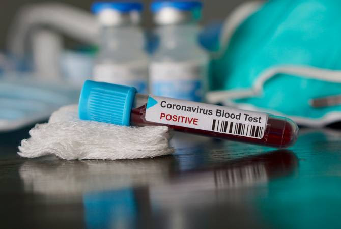 Ermenistan’da koronavirüs vakaları 290’a ulaştı, onlardan 18’i iyileşti, ölüm yok