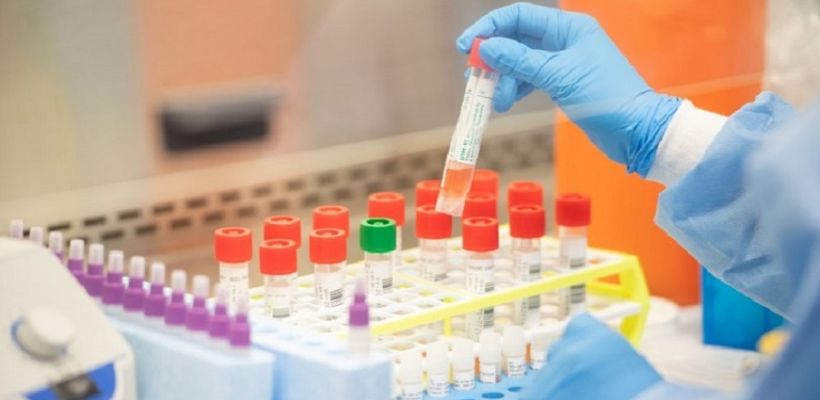Ermenistan artık koronavirüs testlerinin üretimine başladı