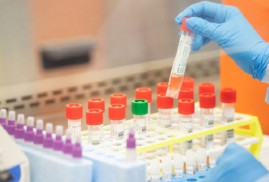 Ermenistan artık koronavirüs testlerinin üretimine başladı
