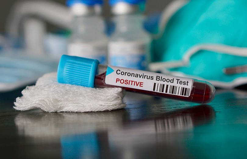 Karabağ’da yurtdışından gelen 3 kişinin koronavirüs test sonuçları pozitif çıktı