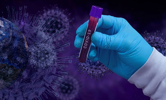Dünya genelinde koronavirüsten can kaybı 423 bin 869’a yükseldi