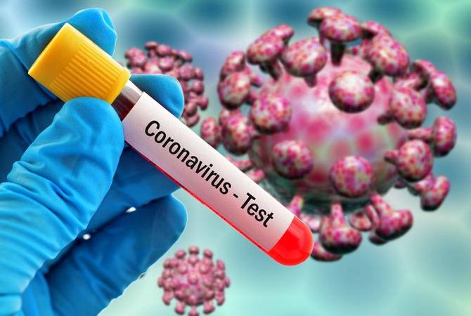 Ermenistan’da bir günde 746 koronavirüs hastası iyileşti, 7 hasta öldü