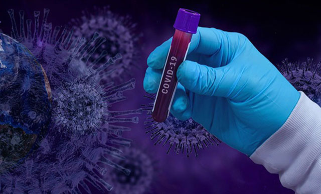 Dünya genelinde koronavirüs vaka sayısı 11.7 milyonu aştı