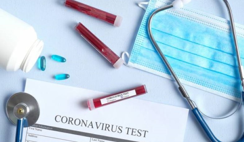 Ermenistan’da koronavirüs vaka sayısı gerilemeye devam ediyor: 1 günde 3250 testten 174’ü pozitif çıktı