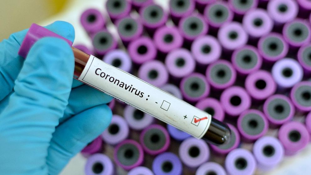 Ermenistan'da koronavirüs hasta sayısı azalıyor