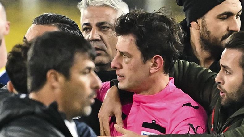 Новый случай нападения на футбольного арбитра в Турции: судье сломали нос (Видео)